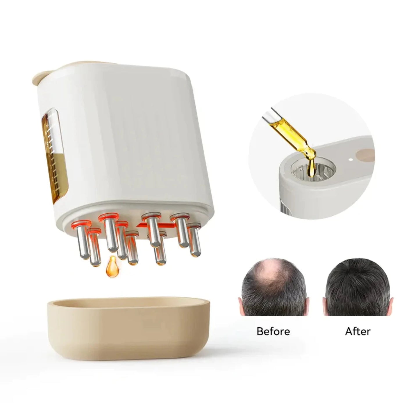 PoshAura™ Electric Oil Applicator & Vibration Scalp Massager | Boost Hair Growth & Scalp Health